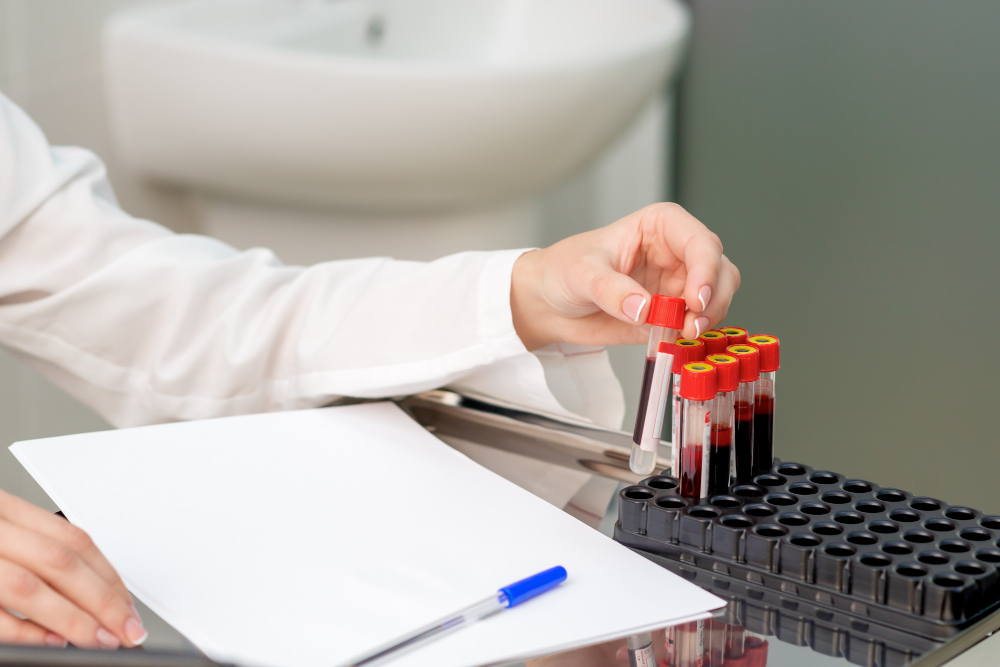 Sânge în urină: Cauze și investigații